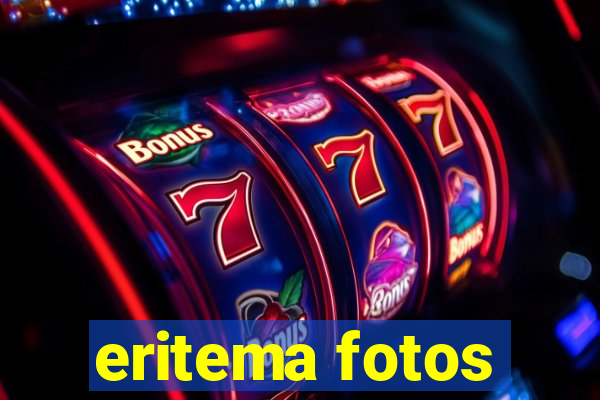 eritema fotos