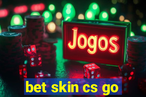 bet skin cs go