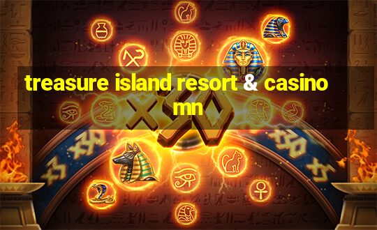 treasure island resort & casino mn